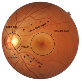 Alzheimer's disease retinal biomarker scan